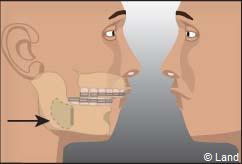 Orthodontie