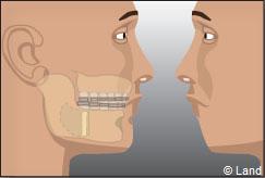Orthodontie